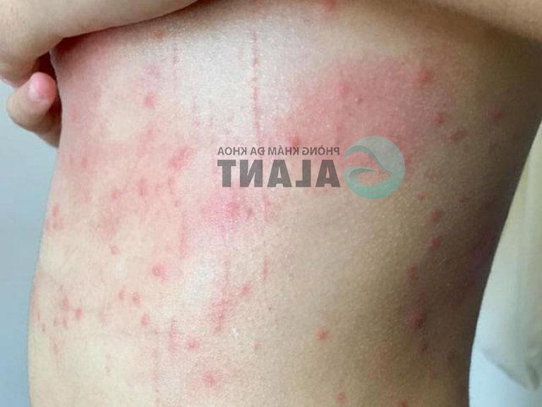 Những dấu hiệu mèo bị sán hiện nay mà người nuôi cần chú ý